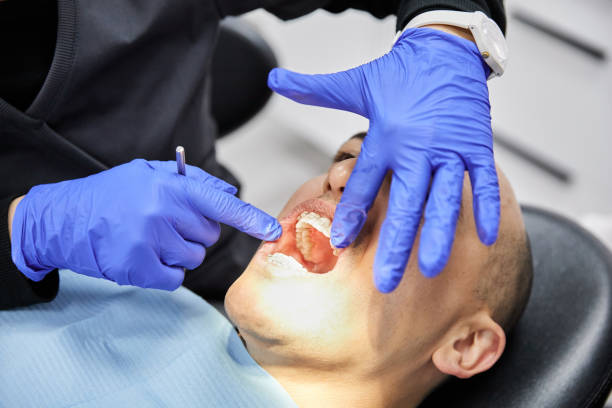 Best Mobile Emergency Dentist in Boulder Creek, CA